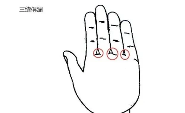 图片[8]-五指指的哪五指-玄妙易卜国学
